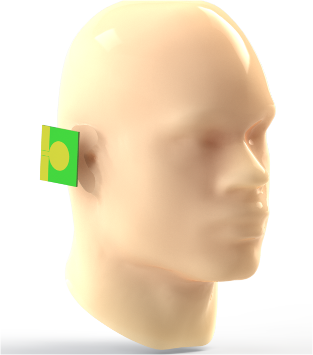 3D-Modell des menschlichen Kopfes, der UMTS-Antennenstrahlung ausgesetzt ist